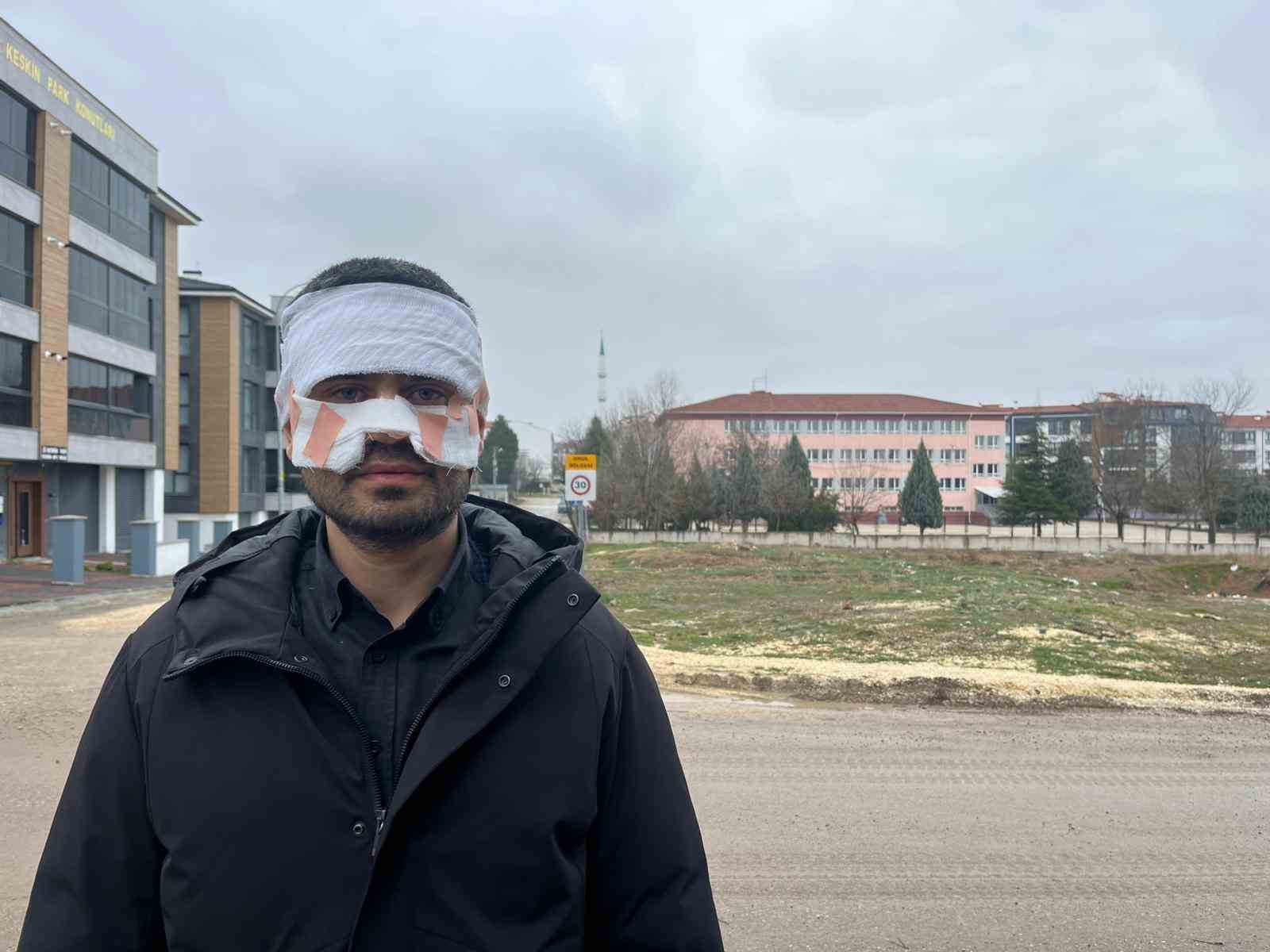 Rehber öğretmenin yüzüne sıcak çay fırlattığı fizik öğretmeni feci şekilde yandı